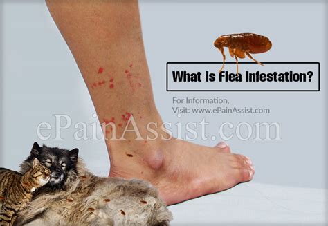 flea infestation in humans.